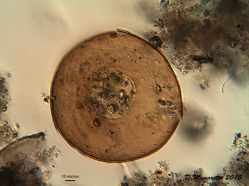 Arcella Vulgaris